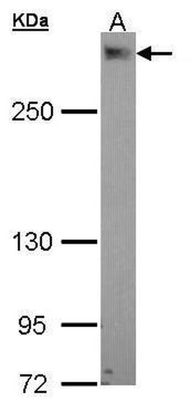 PDZD2 Antibody in Western Blot (WB)