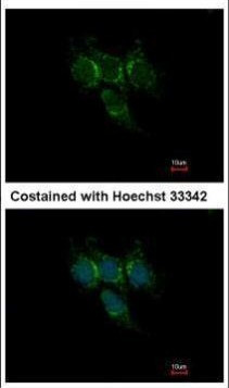GSTA1 Antibody in Immunocytochemistry (ICC/IF)