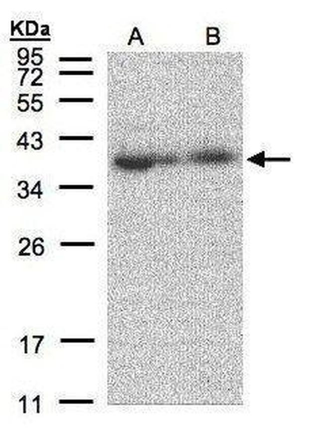 MRPL3 Antibody in Western Blot (WB)
