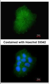 TMEM147 Antibody in Immunocytochemistry (ICC/IF)