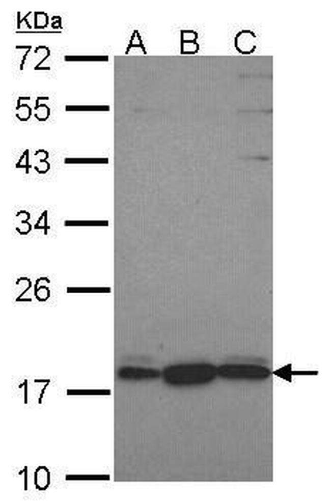 PLEKHJ1 Antibody in Western Blot (WB)