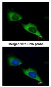 MTMR9 Antibody in Immunocytochemistry (ICC/IF)