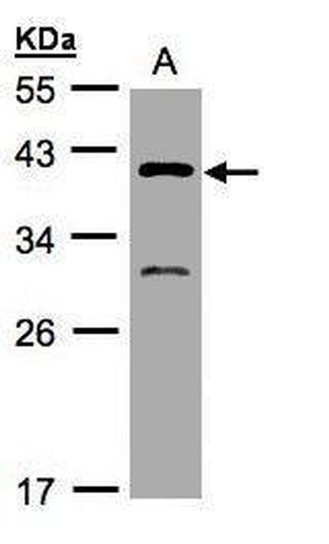 GIPC3 Antibody in Western Blot (WB)