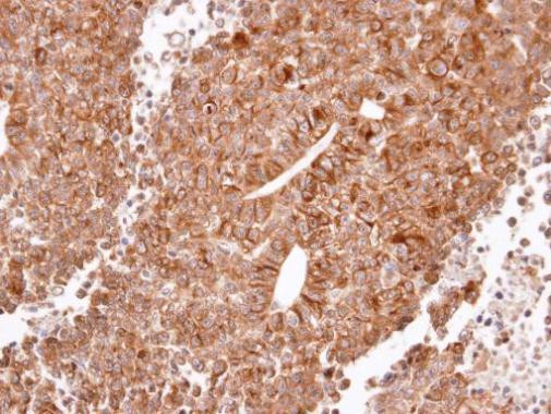 HRH2 Antibody in Immunohistochemistry (Paraffin) (IHC (P))