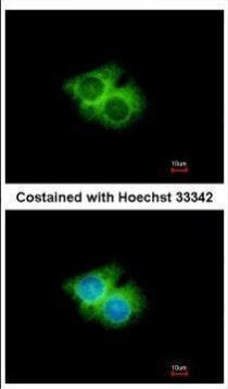 GPR62 Antibody in Immunocytochemistry (ICC/IF)