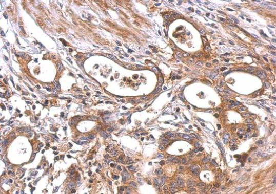 MC1R Antibody in Immunohistochemistry (Paraffin) (IHC (P))