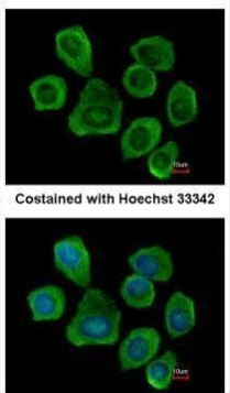 PTGFRN Antibody in Immunocytochemistry (ICC/IF)