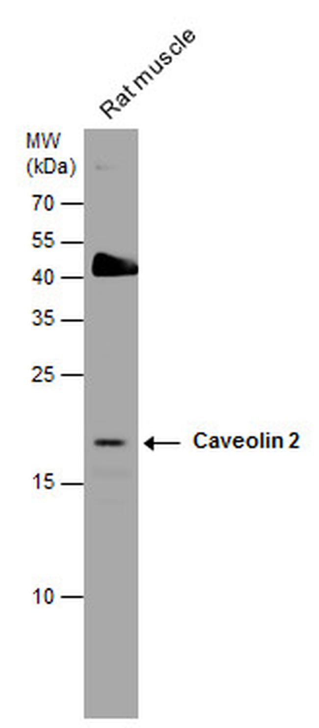 Caveolin 2 Antibody in Western Blot (WB)