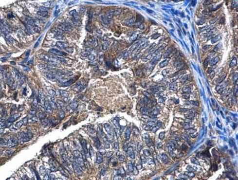 CaMKK beta Antibody in Immunohistochemistry (Paraffin) (IHC (P))