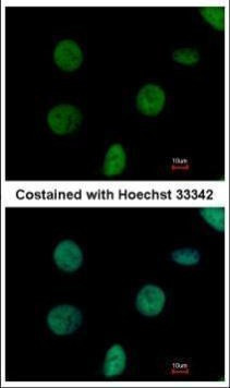 C1orf57 Antibody in Immunocytochemistry (ICC/IF)