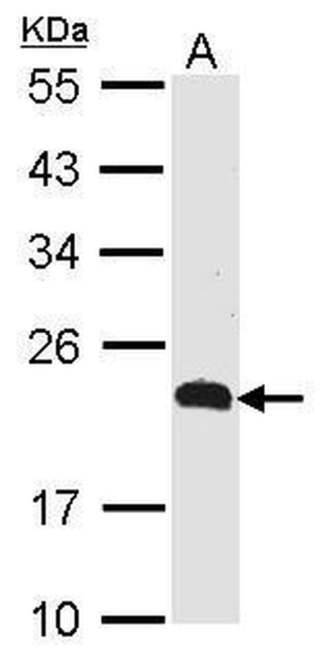 CMTM5 Antibody in Western Blot (WB)