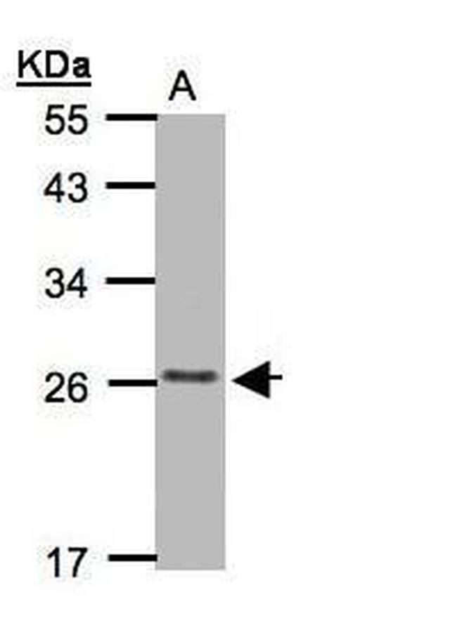 CMTM5 Antibody in Western Blot (WB)