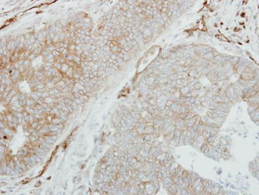HLA-DMB Antibody in Immunohistochemistry (Paraffin) (IHC (P))