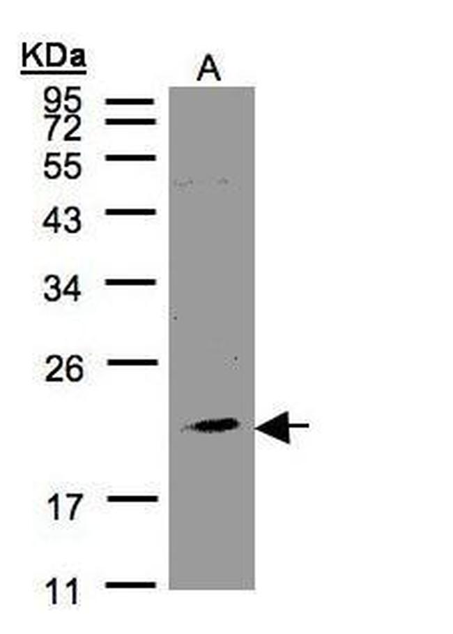 KLRC4 Antibody in Western Blot (WB)