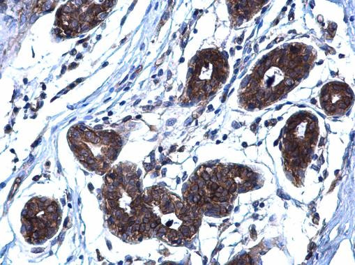 CD254 (RANK Ligand) Antibody in Immunohistochemistry (Paraffin) (IHC (P))