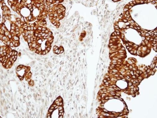 RAP2C Antibody in Immunohistochemistry (Paraffin) (IHC (P))