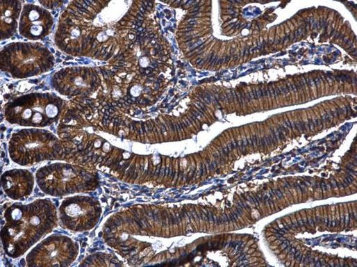 ARF7 Antibody in Immunohistochemistry (Paraffin) (IHC (P))