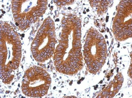TSPAN1 Antibody in Immunohistochemistry (Paraffin) (IHC (P))