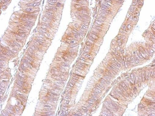 B3GNT3 Antibody in Immunohistochemistry (Paraffin) (IHC (P))