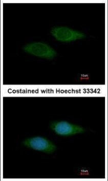 SNTB2 Antibody in Immunocytochemistry (ICC/IF)