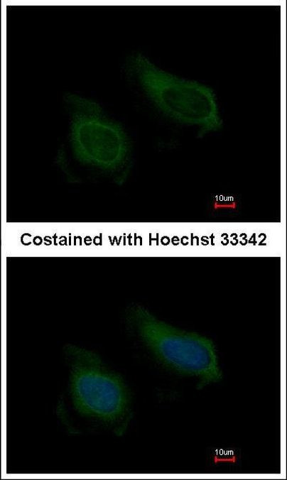 NNT1 Antibody in Immunocytochemistry (ICC/IF)