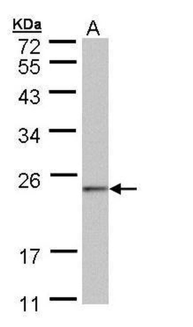 NDUFAF4 Antibody in Western Blot (WB)