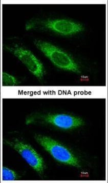 ETFB Antibody in Immunocytochemistry (ICC/IF)