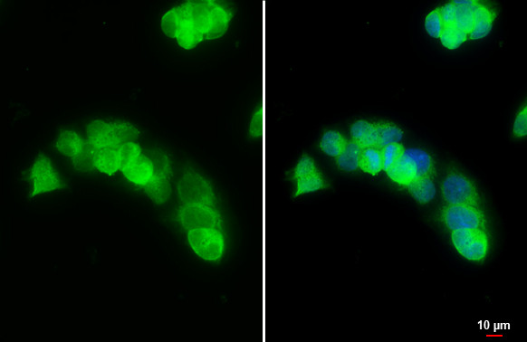 Arginase 1 Antibody in Immunocytochemistry (ICC/IF)