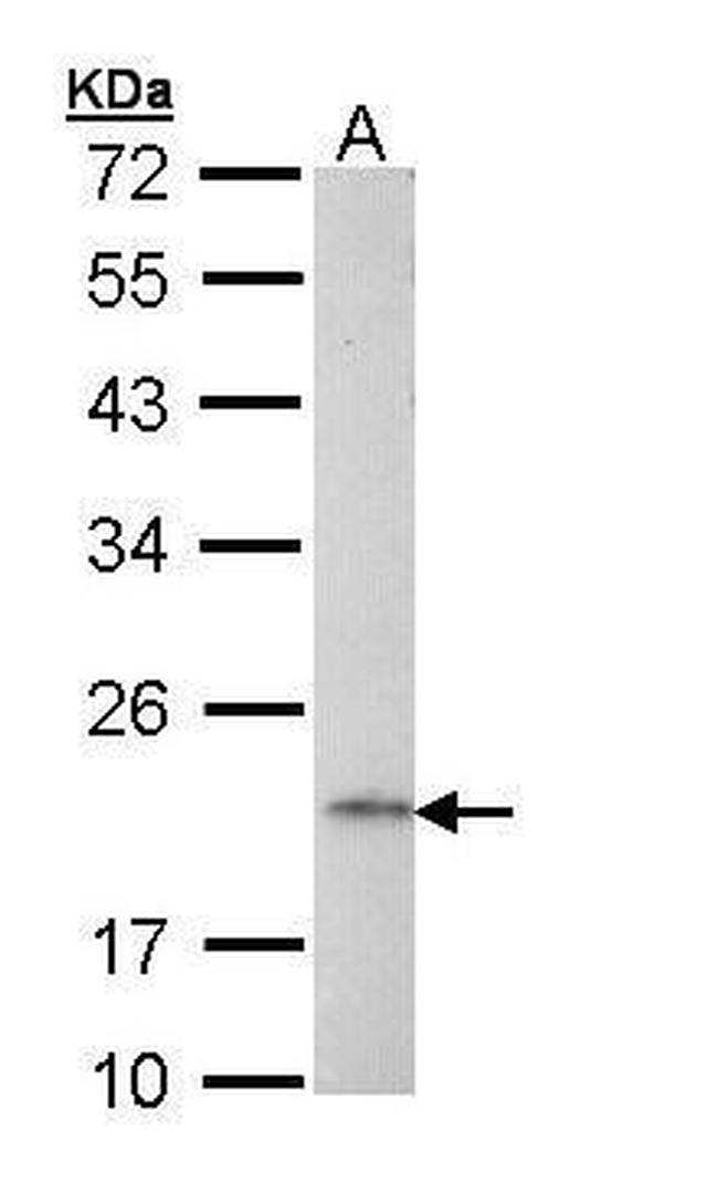AP1S2 Antibody in Western Blot (WB)