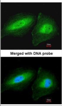 CCDC83 Antibody in Immunocytochemistry (ICC/IF)
