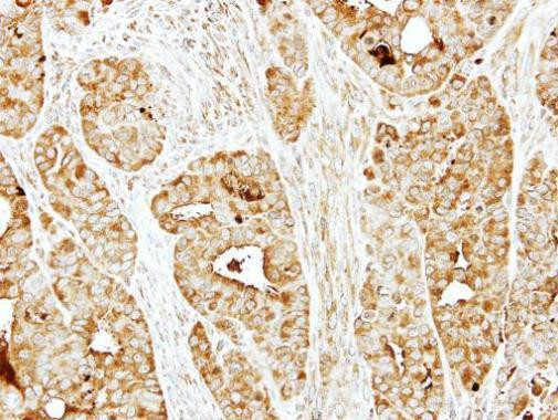 BBS10 Antibody in Immunohistochemistry (Paraffin) (IHC (P))