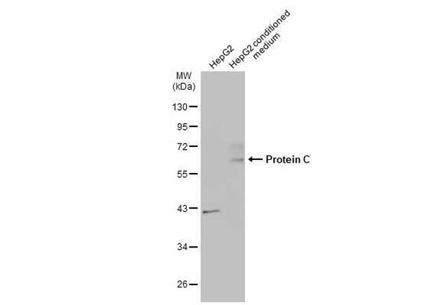 Protein C Antibody in Western Blot (WB)