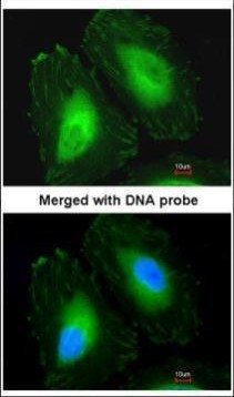 CRYBA4 Antibody in Immunocytochemistry (ICC/IF)