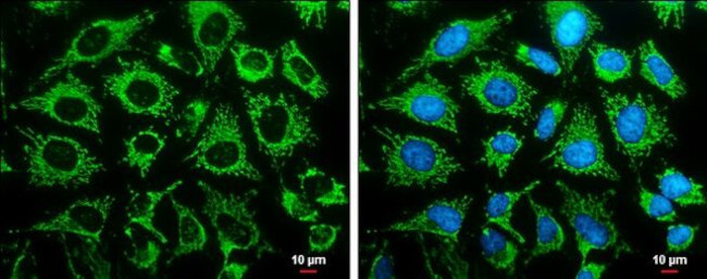 LRP130 Antibody in Immunocytochemistry (ICC/IF)