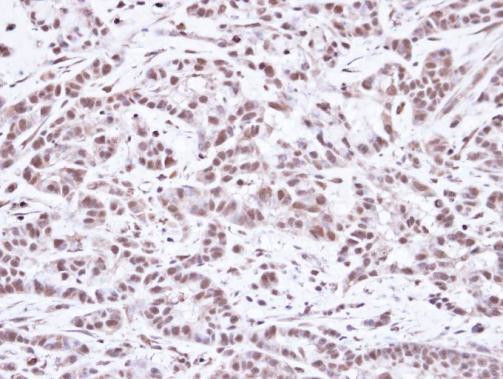 SMC1 Antibody in Immunohistochemistry (Paraffin) (IHC (P))