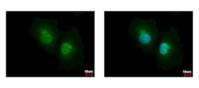 ASL Antibody in Immunocytochemistry (ICC/IF)