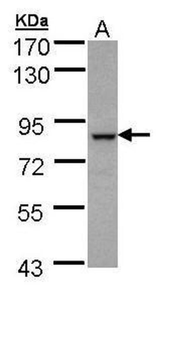 BBS7 Antibody in Western Blot (WB)