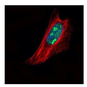 TSPYL1 Antibody in Immunocytochemistry (ICC/IF)