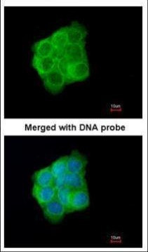 Cytokeratin 13 Antibody in Immunocytochemistry (ICC/IF)
