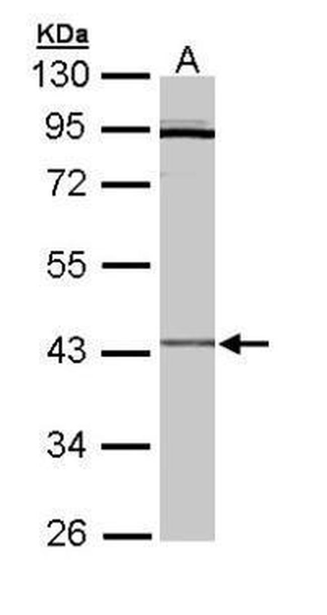 CRLF1 Antibody in Western Blot (WB)