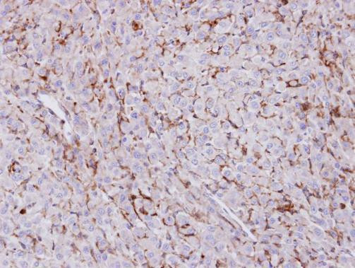 TREH Antibody in Immunohistochemistry (Paraffin) (IHC (P))