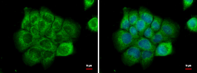 NPR3 Antibody in Immunocytochemistry (ICC/IF)