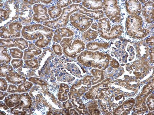 MCD Antibody in Immunohistochemistry (Paraffin) (IHC (P))