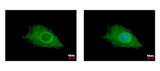 FIG4 Antibody in Immunocytochemistry (ICC/IF)