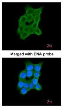 CRTAP Antibody in Immunocytochemistry (ICC/IF)