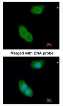 EHBP1 Antibody in Immunocytochemistry (ICC/IF)