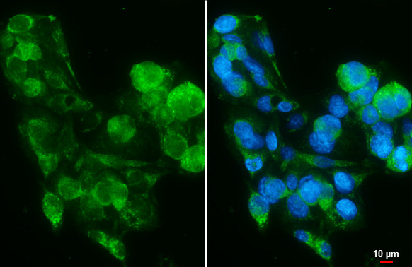 PIGR Antibody in Immunocytochemistry (ICC/IF)