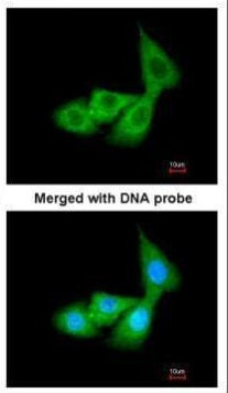 SERPINA6 Antibody in Immunocytochemistry (ICC/IF)