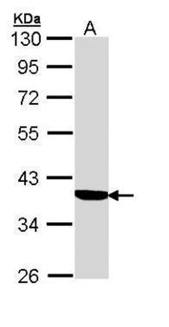 SERPINA6 Antibody in Western Blot (WB)