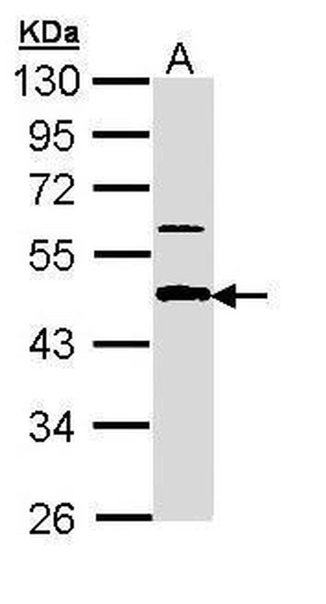 APBB3 Isoform A Antibody in Western Blot (WB)